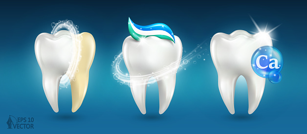 Set of dental teeth, 3d models dental examination teeth, whitening and repair. Realistic vector illustration isolated on blue background