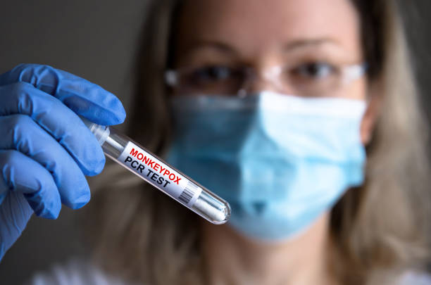 Monkeypox PCR test tube in doctors hand stock photo