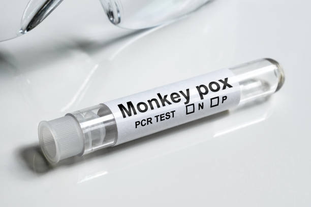 Monkeypox PCR test tube close-up. Equipment for monkey pox virus diagnostics stock photo