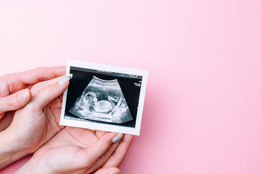 Imagen de ultrasonido foto de bebé embarazada. Manos de mujer sosteniendo la imagen de embarazo de ultrasonido sobre fondo rosa. Embarazo, medicina, farmacia, atención médica y concepto de personas. photo