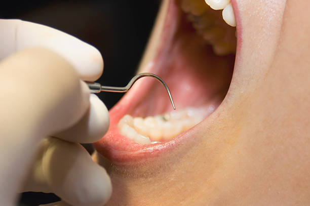 dentist at work stock photo