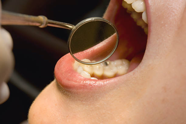 dentist mirror inspection stock photo