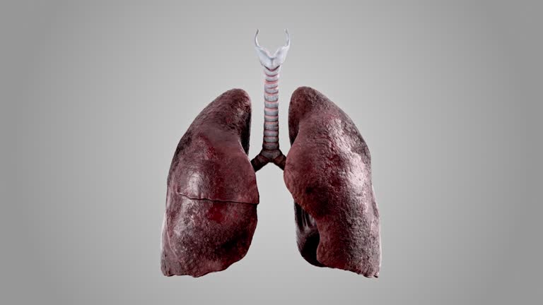 514 Smokers Lungs Stock Videos and Royalty-Free Footage - iStock | Lung cancer, Heart disease, Healthy lungs 514 Smokers Lungs Stock Videos and Royalty-Free Footage - iStock | Lung cancer, Heart disease, Healthy lungs