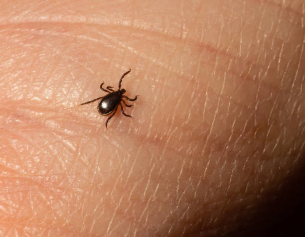 istock Infectious Encephalitis Ixodes Scapularis or Persulcatus Deer Tick Insect on Skin. Encephalitis Virus or Lyme Borreliosis Disease Infected Ixodes Tick Arachnid Parasite Bite Macro 1404161408