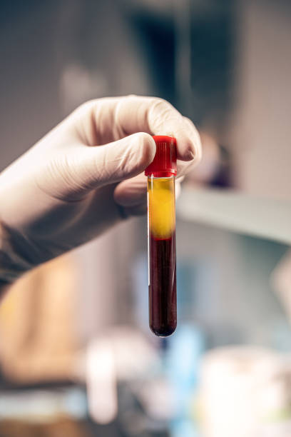 Extraction of plasma from blood stock photo