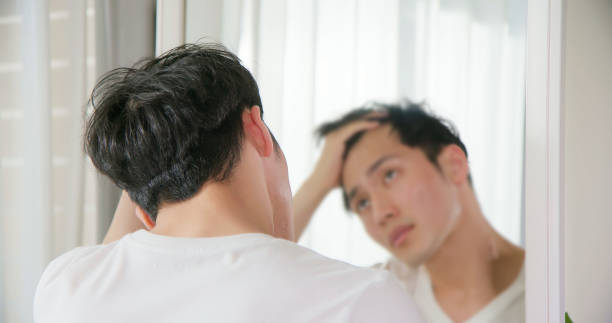 man worried about hair loss - east asian ethnicity japanese ethnicity asian ethnicity one person imagens e fotografias de stock
