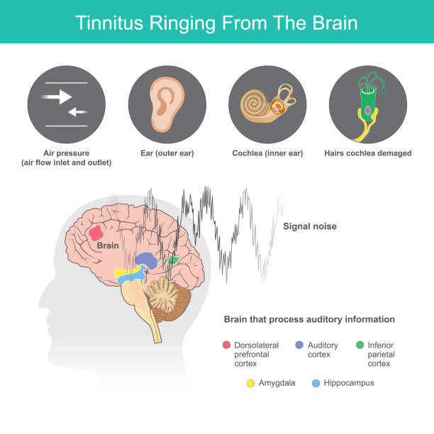 Ears Ringing Randomly 1,000+ Tinnitus Stock Illustrations, Royalty-Free Vector Graphics ...