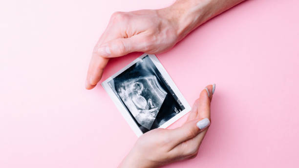 超音波画像妊娠中の赤ちゃんの写真。ピンクの背景に超音波妊娠画像を保持している女性の手。妊娠の概念, 母性, 赤ちゃんの誕生のための期待. - ultrasound fetus development embryo ストックフォトと画像