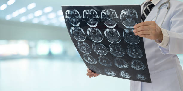 cervello a raggi x - doctor brain x ray x ray image foto e immagini stock