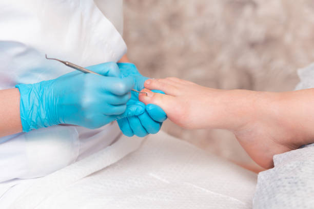 a chiropodist does a pedicure for the client's feet, cleaning the nails with a double-sided curette. close up. the concept of salon professional nail care - podiatrist podiatry pedicure chiropodist imagens e fotografias de stock