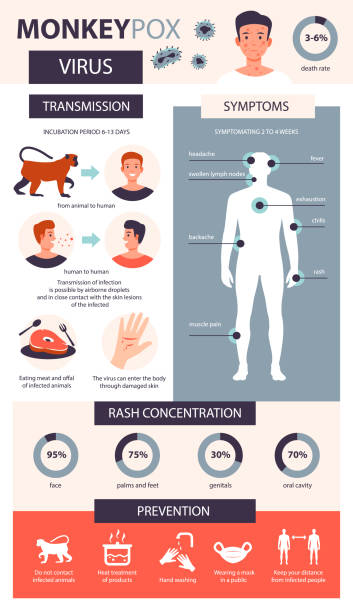monkey pox infographic. infection, symptoms, prevention of the disease of monkey pox. flat vector illustration - 猴痘 插圖 幅插畫檔、美工圖案、卡通及圖標