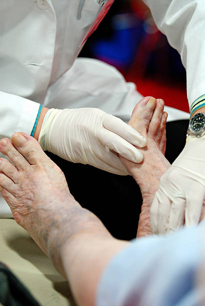 doctor's hände berühren diabetes patienten's foot - human foot diabetes ulcer senior adult stock-fotos und bilder