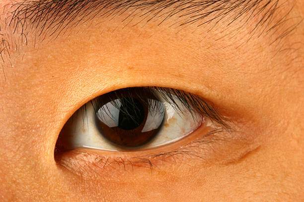 asian eye