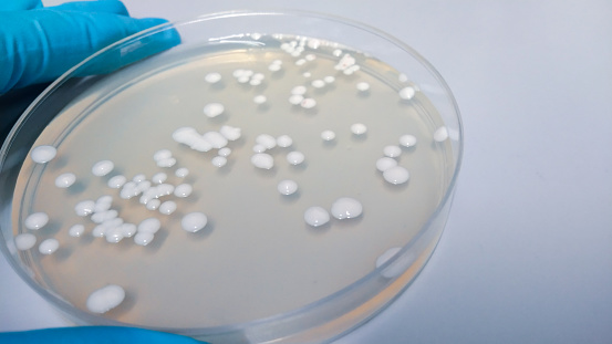 Close-up shot of a petri dish for checking an antibiotic in the laboratory.