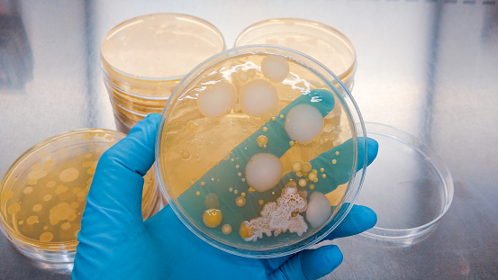 Close-up shot of a petri dish for checking an antibiotic in the laboratory.