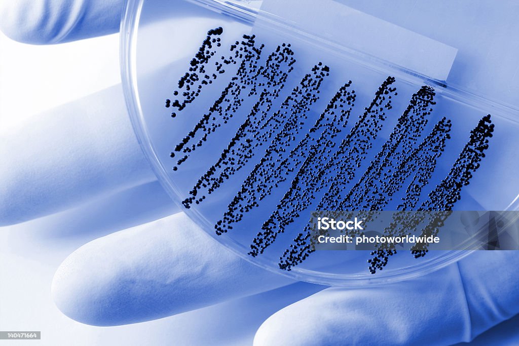 A plate showing a dangerous microorganism working in laboratory Agar Jelly Stock Photo