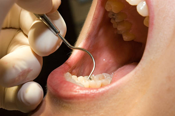 dentist inspection stock photo