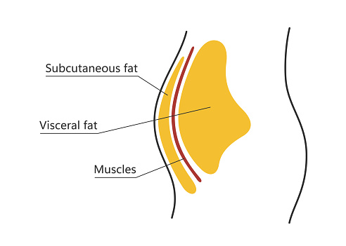 Visceral and subcutaneous fat around waistline. Location of visceral fat in abdominal cavity. Types of human obesity. Medical scheme. Vector illustration isolated on white background