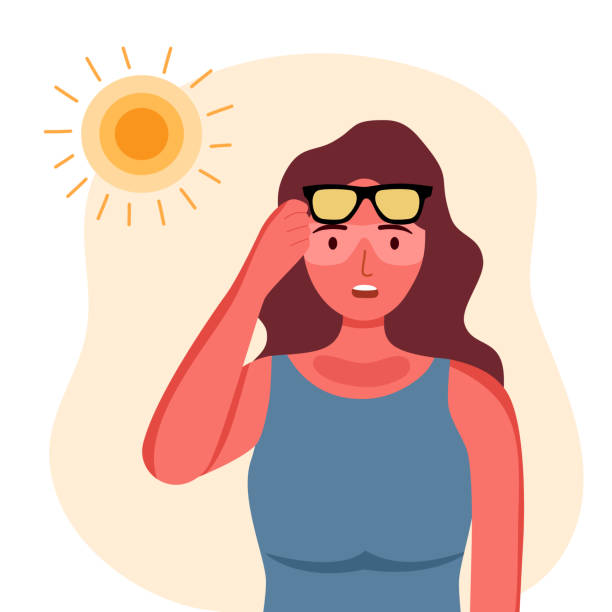 ilustraciones, imágenes clip art, dibujos animados e iconos de stock de mujer joven con quemaduras solares en la piel bajo la luz solar fuerte en diseño plano. - quemado por el sol