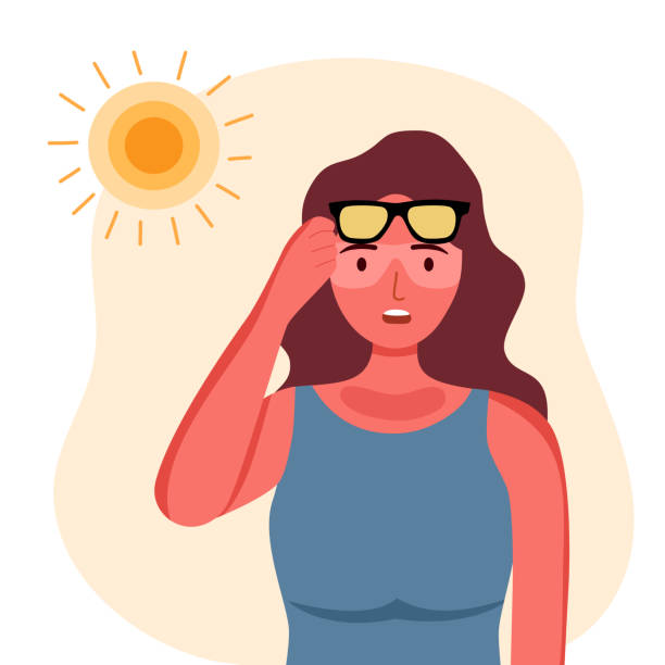 Young woman with skin sunburn under strong sunlight in flat design. Young woman with skin sunburn under strong sunlight in flat design. sunbathing stock illustrations