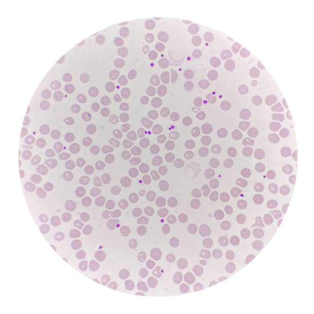 Red blood cell with Platelet in blood smear. Red blood cell with Platelet in blood smear.Hematology. epstein barr virus photos stock pictures, royalty-free photos & images