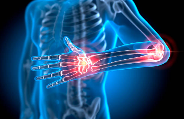 Painful Hand and Elbow Joints X Ray Illustration of Painful Hand and Elbow Joint - Medical 3D Illustration joint pain stock pictures, royalty-free photos & images