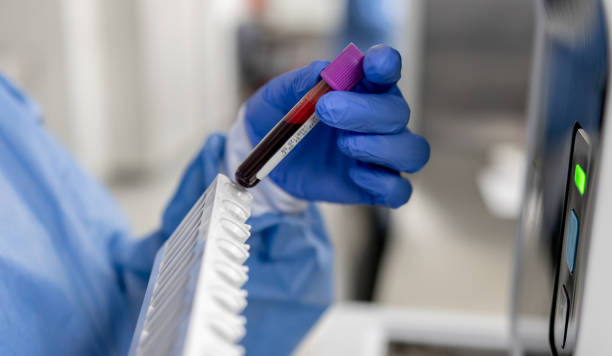 nahaufnahme eines technikers, der blutproben im labor analysiert - blutentnahmeröhrchen stock-fotos und bilder
