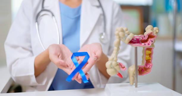 Colon Cancer concept close up of female doctor hand wear white coat holds blue ribbon in front of her chest with colon model on table colonoscopy stock pictures, royalty-free photos & images