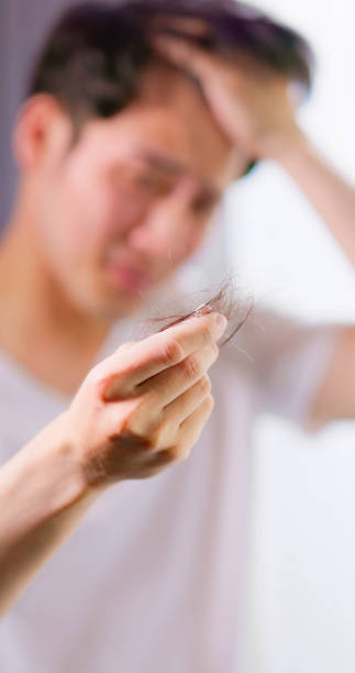 istock man worried about hair loss 1405013125