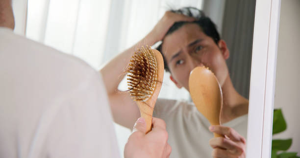 man worried about hair loss - east asian ethnicity japanese ethnicity asian ethnicity one person imagens e fotografias de stock