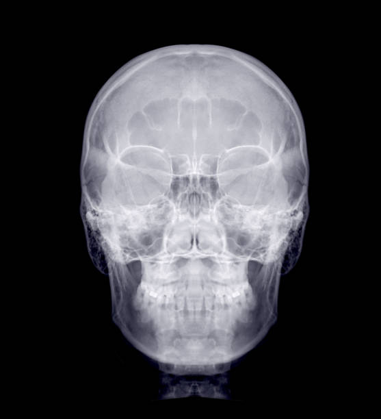 人間の正面図の頭蓋骨x線画像。 - shock color image vertical toned image ストックフォトと画像