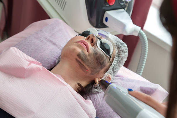 istock Facial cleansing procedure with carbon peeling in a spa salon 1405071676