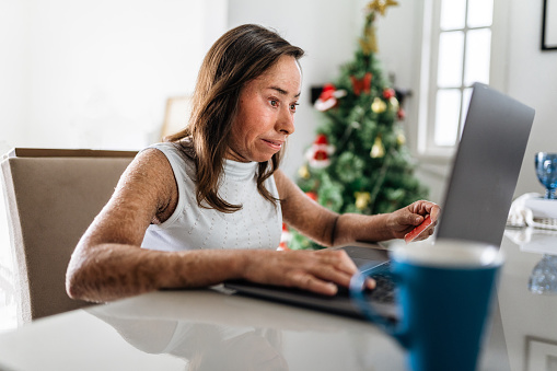 Ichthyosis woman shopping online at christmas