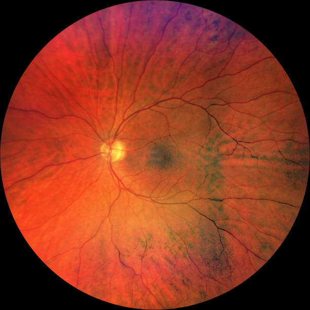 istock Photograph of the Fundus Oculi: left eye 1405207120