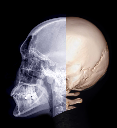 Skull x-ray image of Human lateral view and 3D rendering  image  isolated on Black Background.