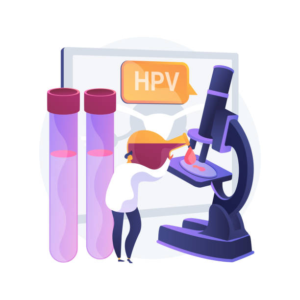 HPV test abstract concept vector illustration. HPV test abstract concept vector illustration. Human papillomavirus test kit, results, testing for man, examination for women, cervical cancer prevention, HPV early diagnostics abstract metaphor. pap smear stock illustrations