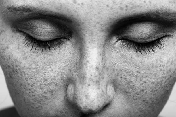 istock woman with freckles 1405259373