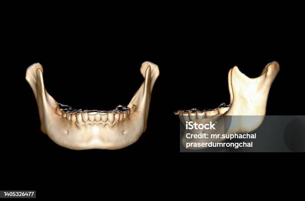 Ct Scan Of Mandible Bone 3d Rendering Image Stock Photo - Download Image Now - 3D Scanning, Anatomy, Ancient