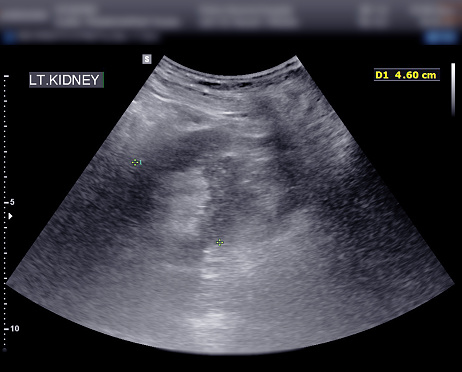 Computational tomography image of the abdominal and pelvic regions.