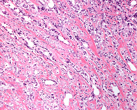 Histology microscope image of Meissner's corpuscle in the dermis of the skin (400x)
