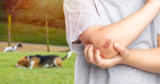 injured elbow of a child Closeup of an injured elbow of a child who was playing with the dog in the grass scab arm stock pictures, royalty-free photos & images