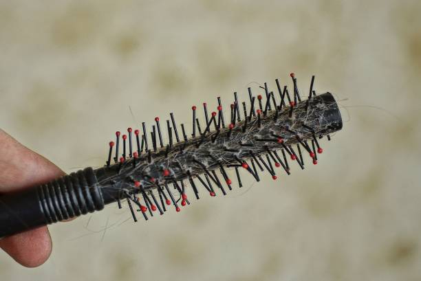 istock hand holds a black dirty plastic comb with hair 1405451584