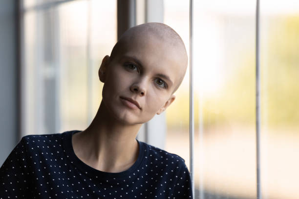 istock Millennial woman with shaved head suffering from oncological disease 1405601366