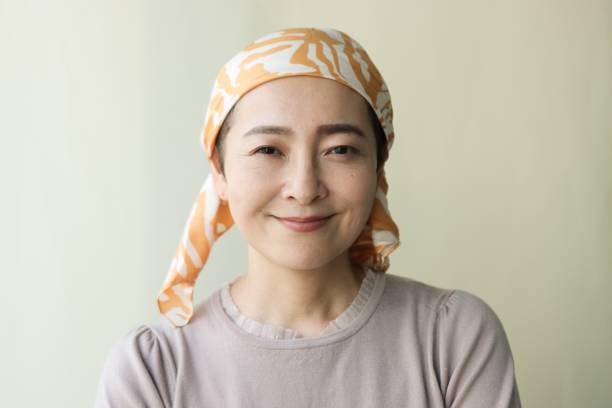 Portrait of beautiful cancer patient in Asia stock photo