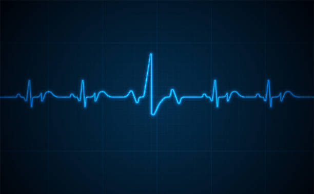 illustrazioni stock, clip art, cartoni animati e icone di tendenza di monitoraggio ecg di emergenza. pulsore di cuore al neon incandescente blu. battito cardiaco. elettrocardiogramma - elettrocardiogramma