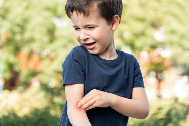 child scratching arm because an insect bite - mosquito child bug bite scratching imagens e fotografias de stock
