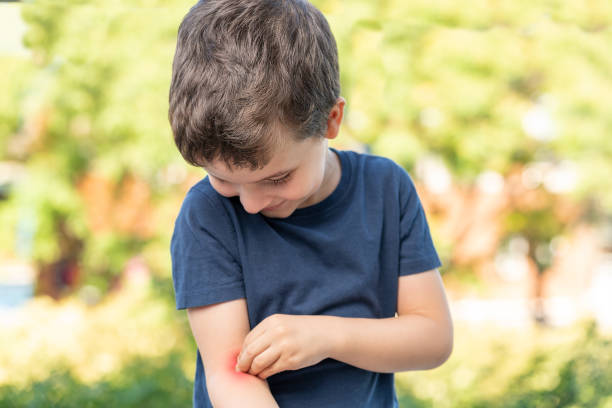 Child scratching and looking his arm Child scratching and looking at his arm because it itches in a park with green background bug bite stock pictures, royalty-free photos & images