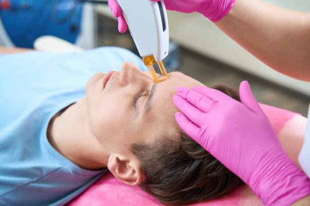 istock Young man doing laser epilation for face in clinic 1405704055