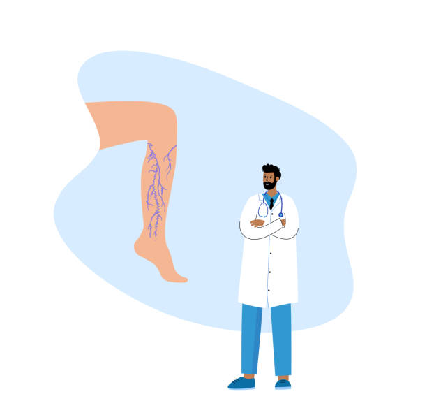 illustrations, cliparts, dessins animés et icônes de les varices soin - venous insufficiency