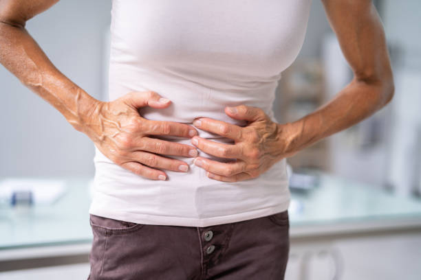 istock Diverticulitis Infection Or Inflammation In Intestines 1405792553